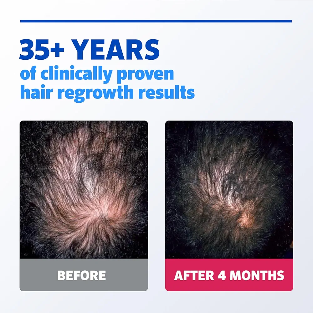 Men’s Rogaine 5% Minoxidil Liquid – 3 Month Supply - Image 3